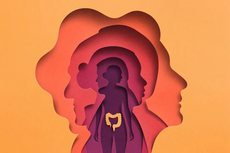 Aumenta el cáncer de colon entre los adultos jóvenes y esto es lo que debes saber. El cancer afecta a las mujeres